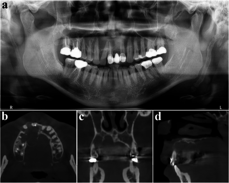 Figure 15