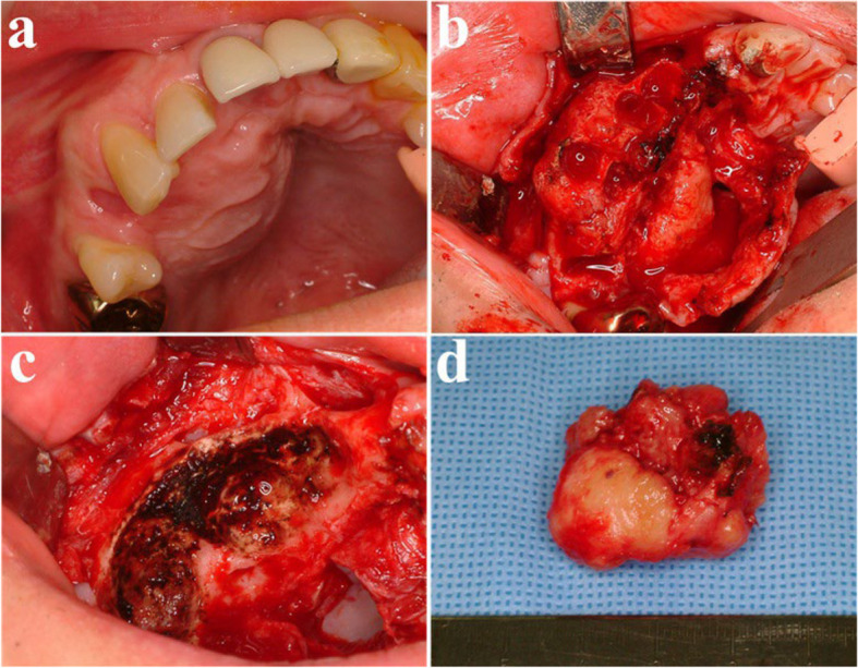 Figure 16