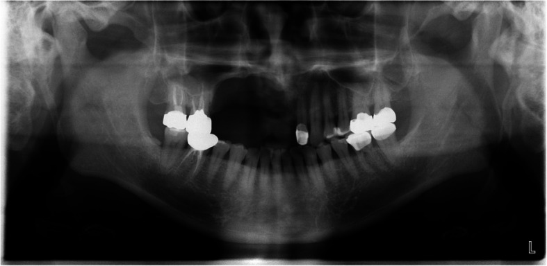 Figure 18