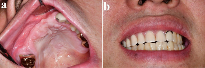 Figure 19