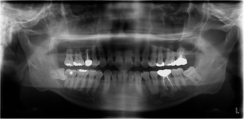 Figure 20