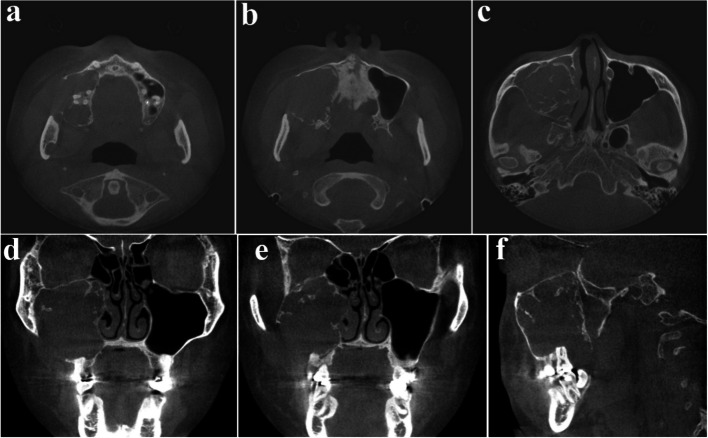 Figure 21
