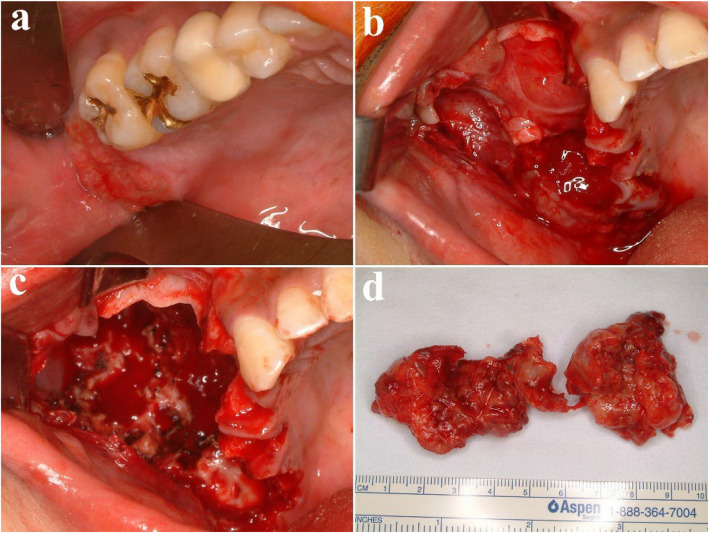 Figure 22