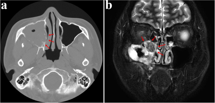 Figure 23