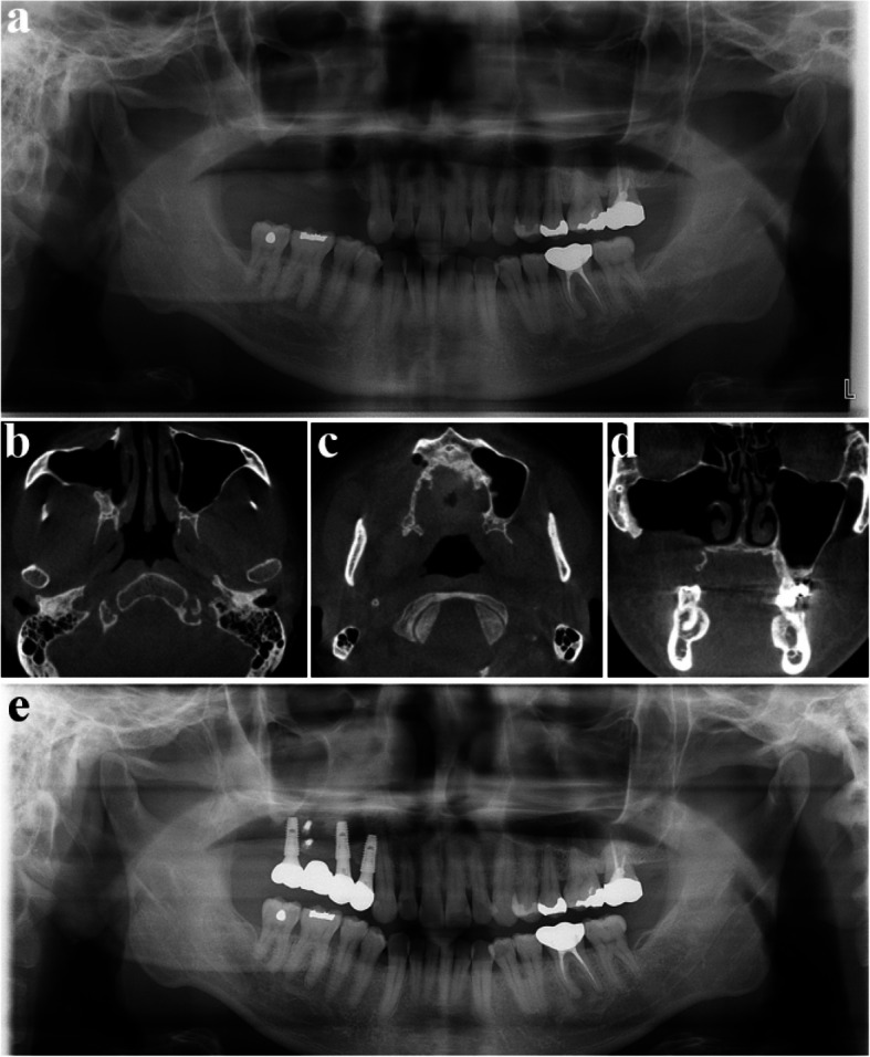 Figure 24