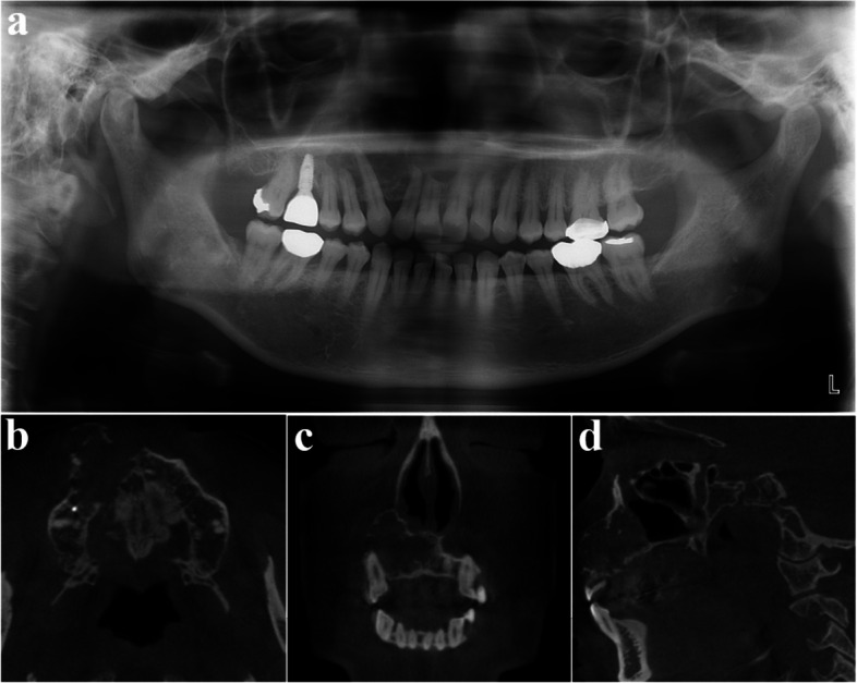 Figure 25