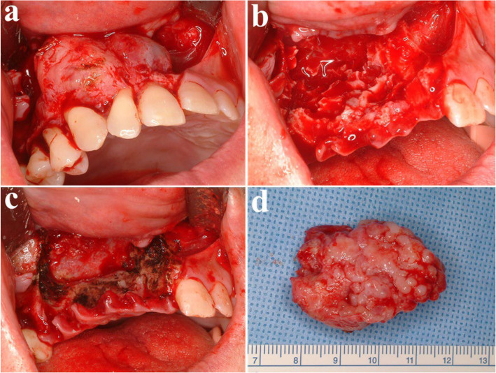Figure 26