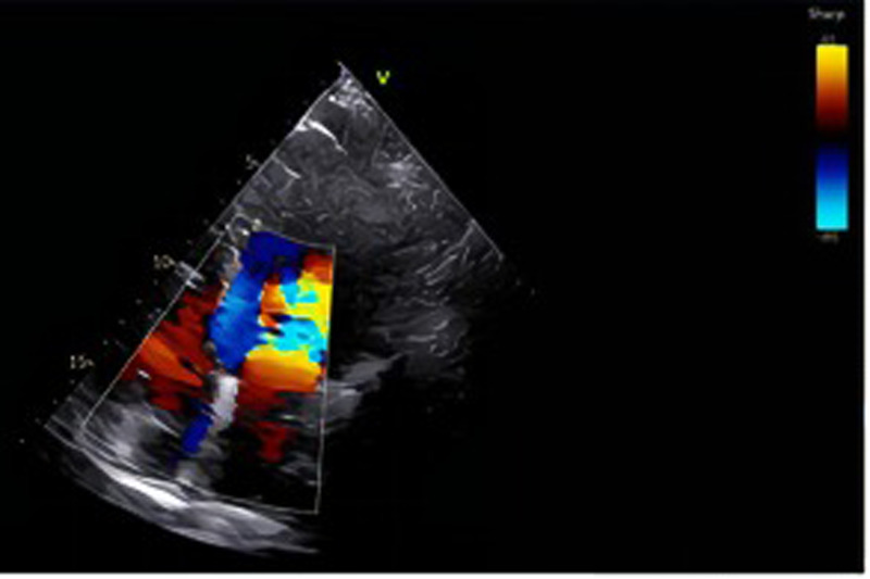 Figure 1