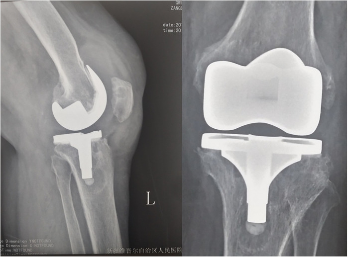 Figure 2