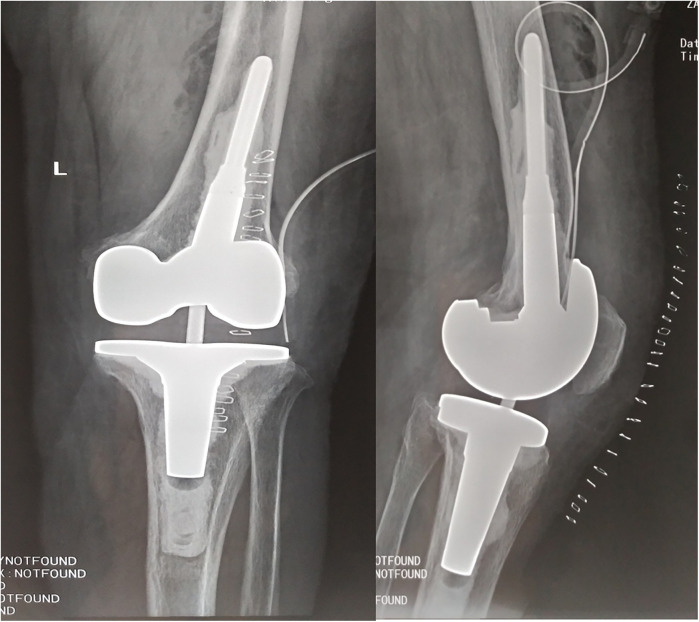 Figure 4