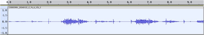 FIGURE 4