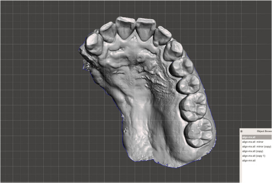 FIGURE 3