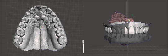 FIGURE 4