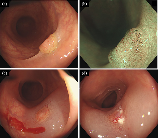 FIGURE 1