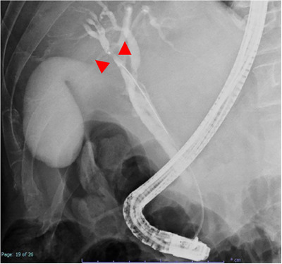 FIGURE 2