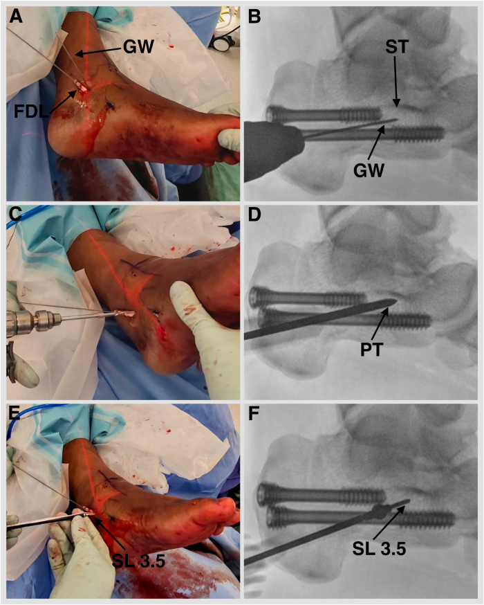 Figure 12