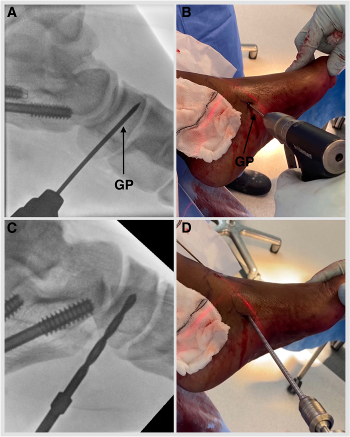 Figure 13