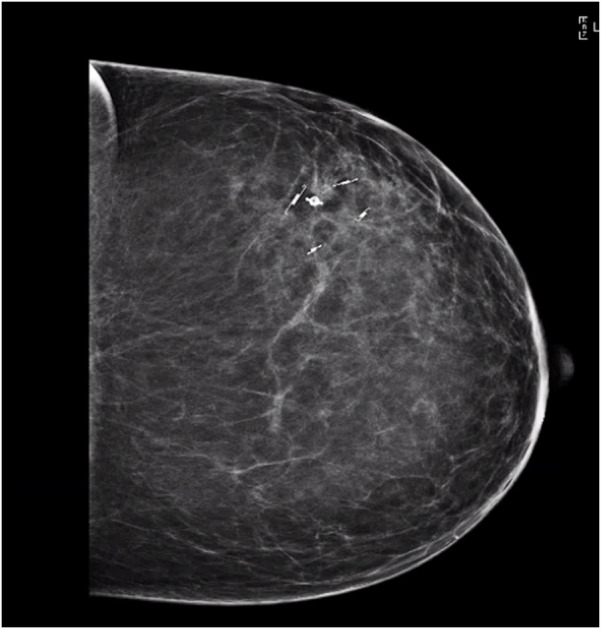 Figure 3