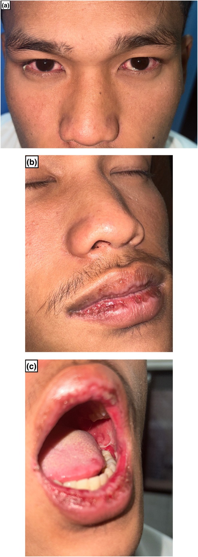 FIGURE 1