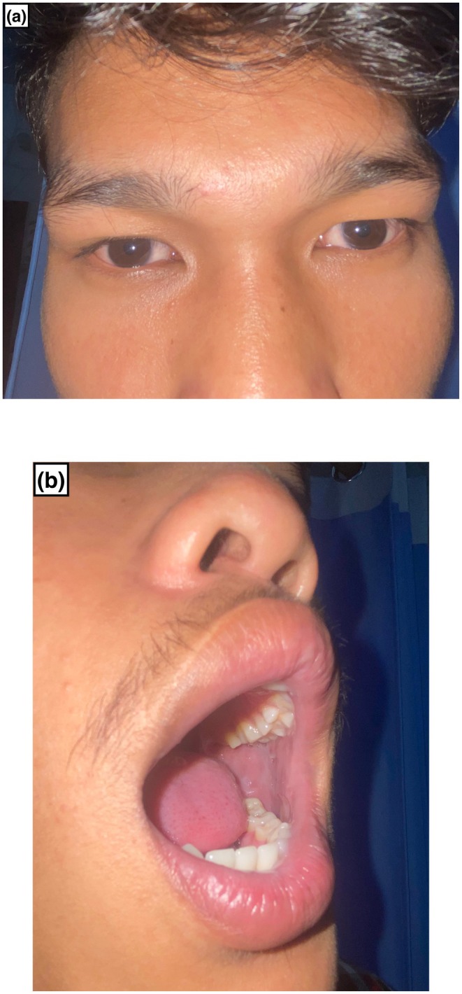 FIGURE 2