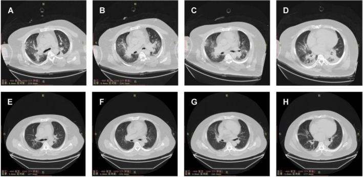 FIGURE 2