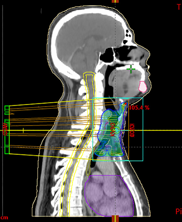 Figure 3