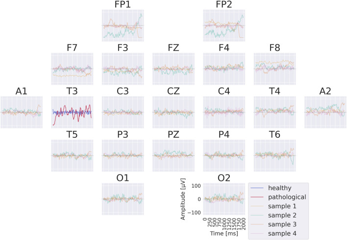 FIGURE 4