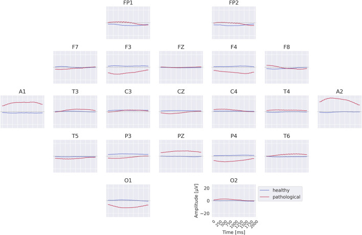 FIGURE 10