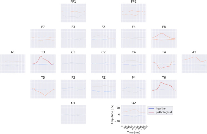 FIGURE 11