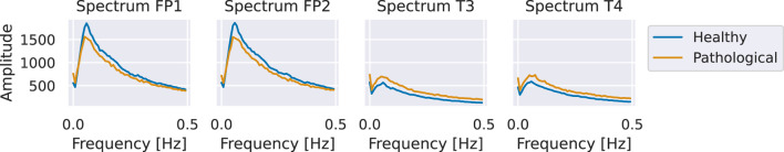 FIGURE 14