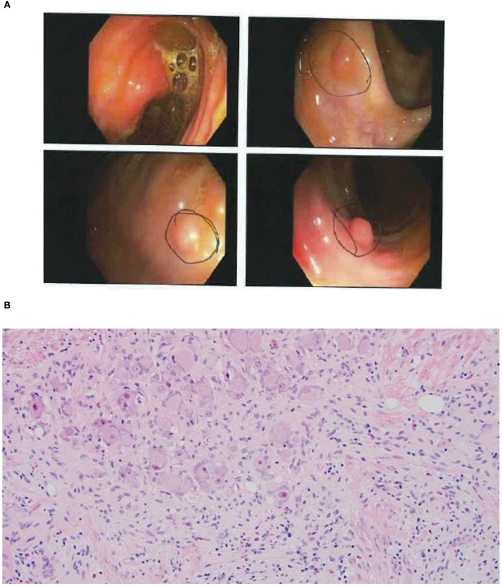 Figure 1