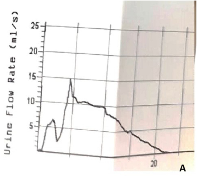 Figure 16