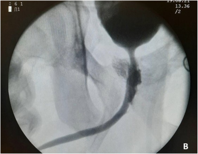 Figure 17