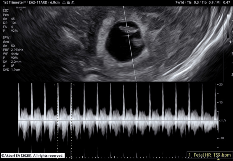 Figure 6