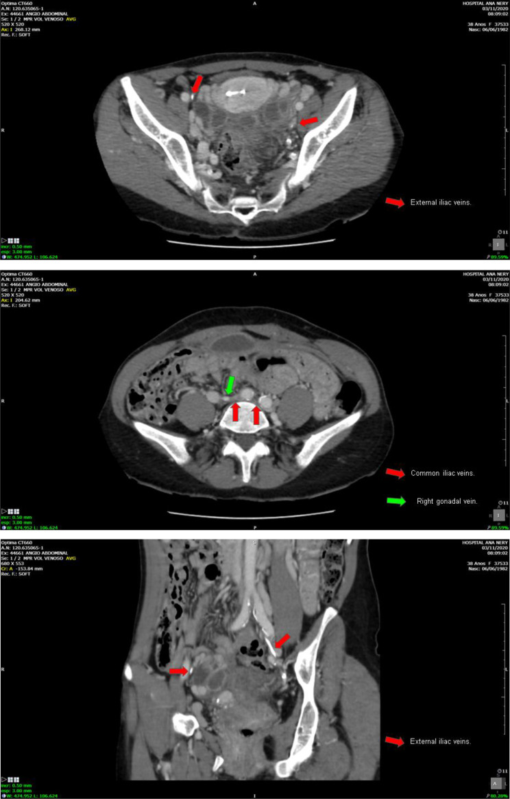 Figure 3