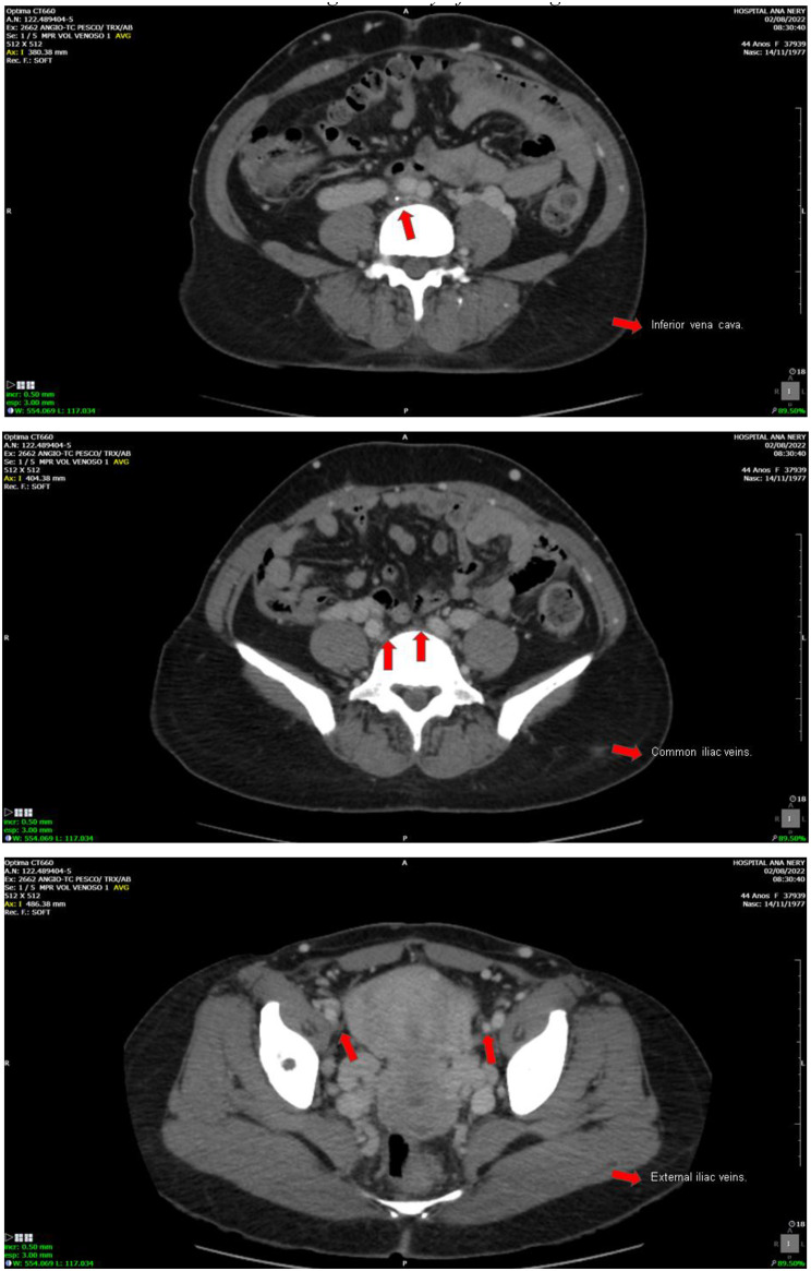 Figure 4