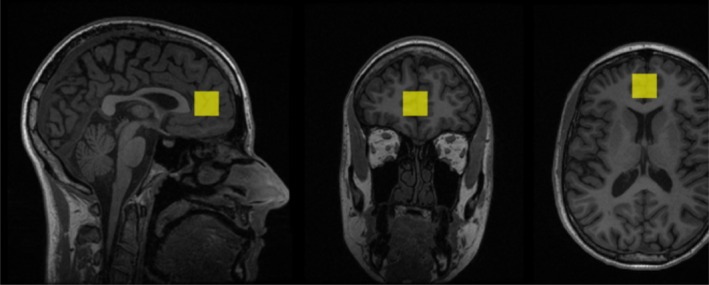 FIGURE 1
