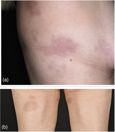 FIGURE 3