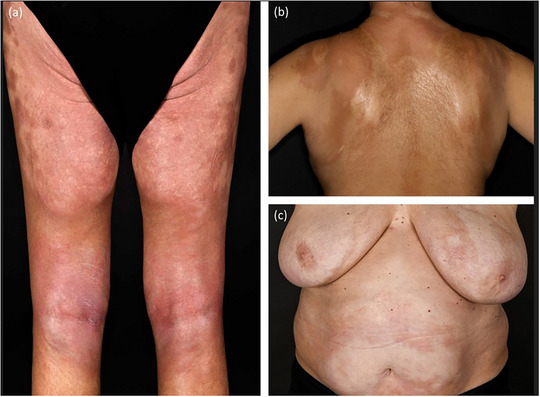 FIGURE 4