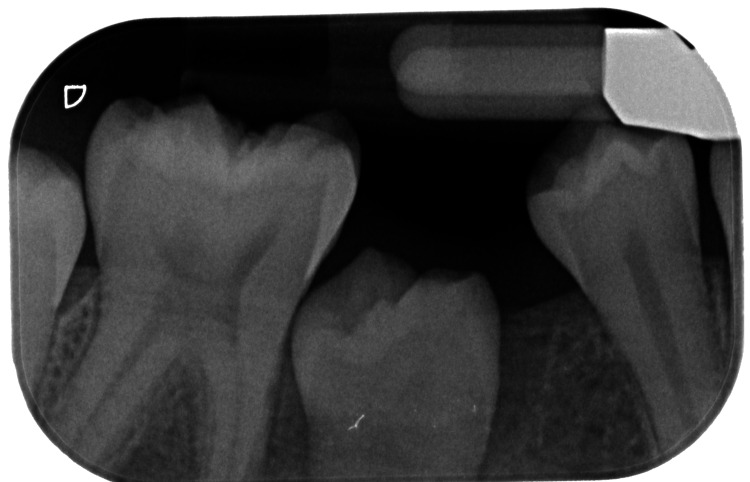 Figure 9