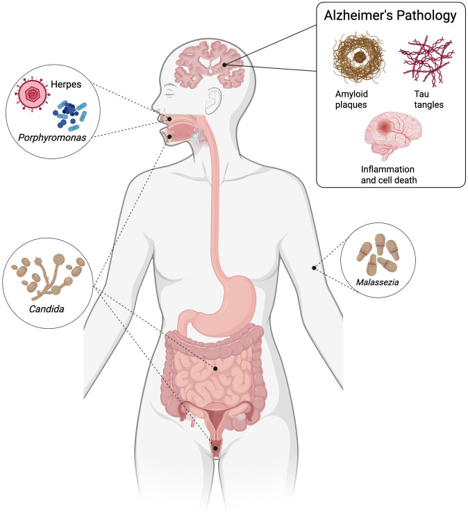Fig 1