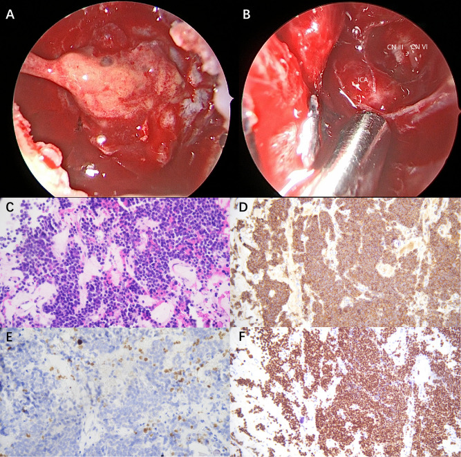 Figure 2