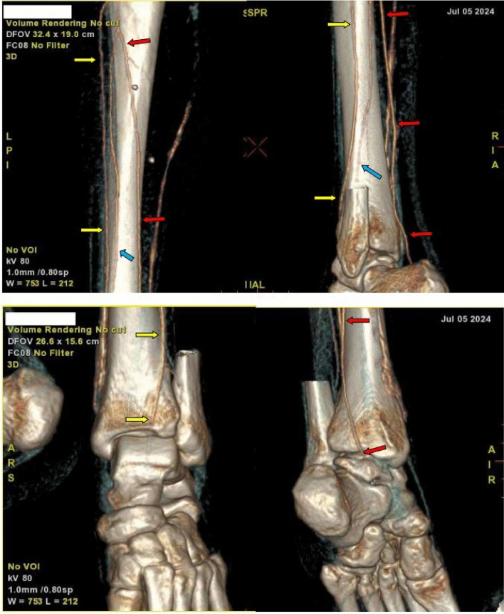 Figure 9