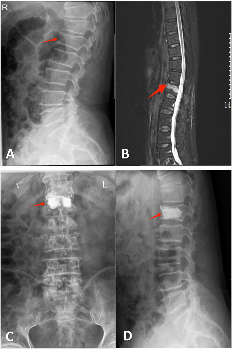 Figure 1