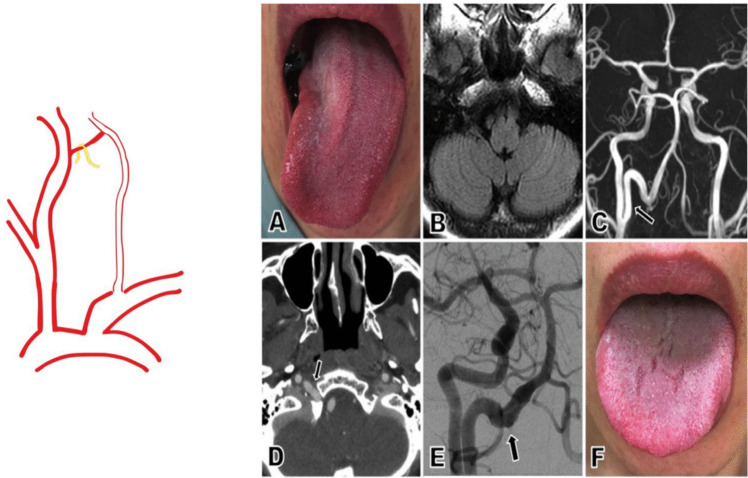 Figure 6