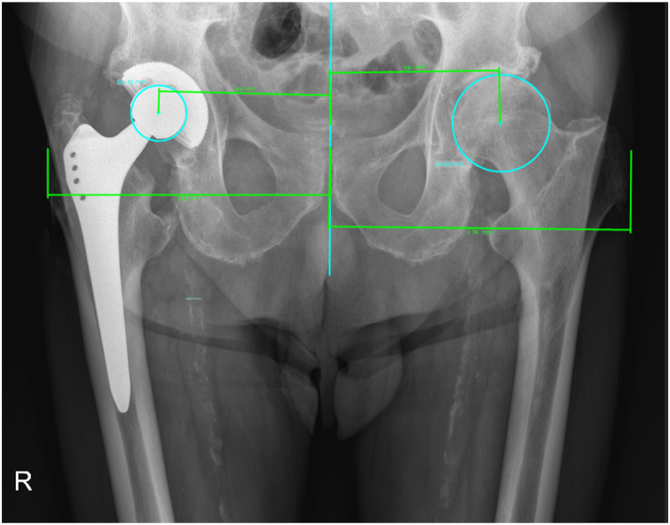 Figure 10
