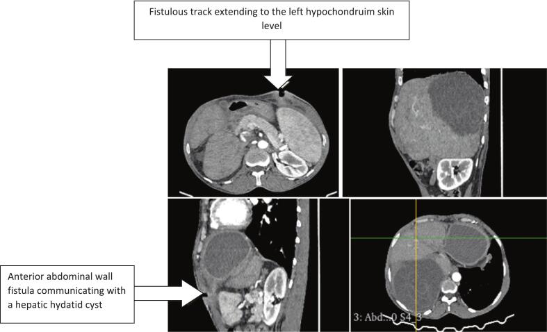 Figure 2