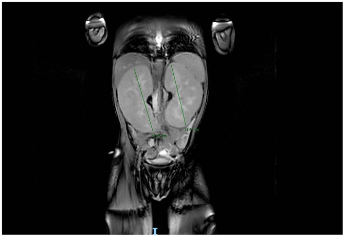 FIGURE 3