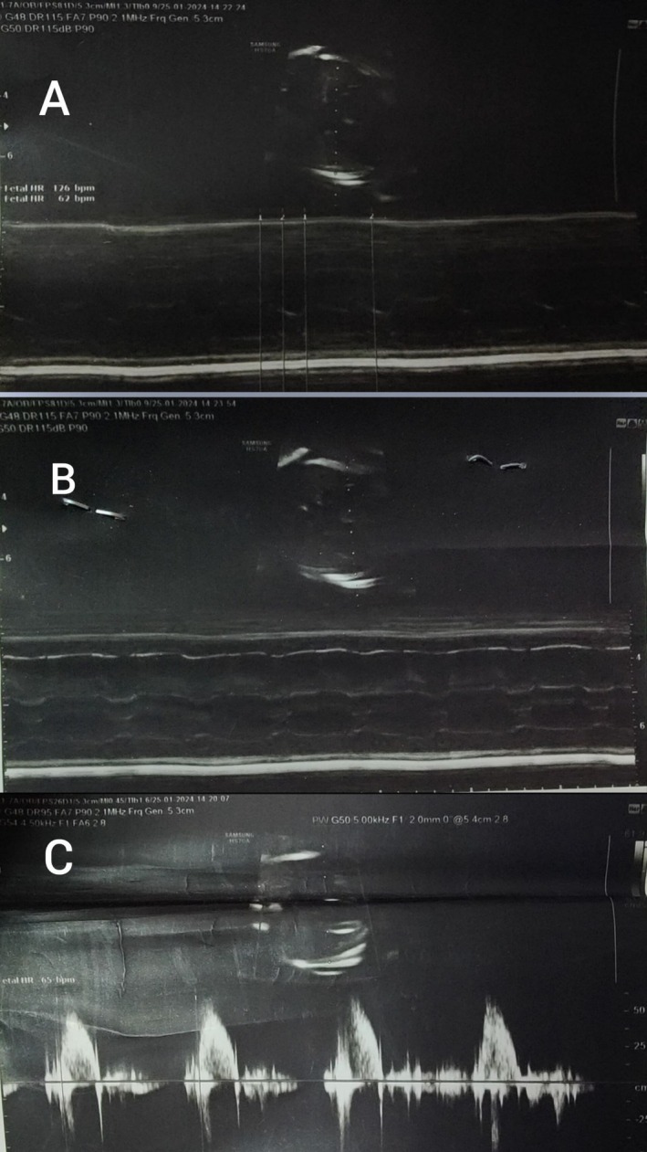 FIGURE 1