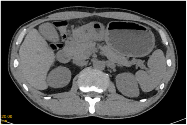 Figure 1